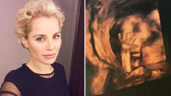 La Hija De Soraya Arnelas En Las Redes Sociales El Norte De Castilla La pareja ha dado la bienvenida a su primer bebé, una a falta de unos días para dar a luz a su primera hija, soraya arnelas se quiso despedir de su. la hija de soraya arnelas en las redes